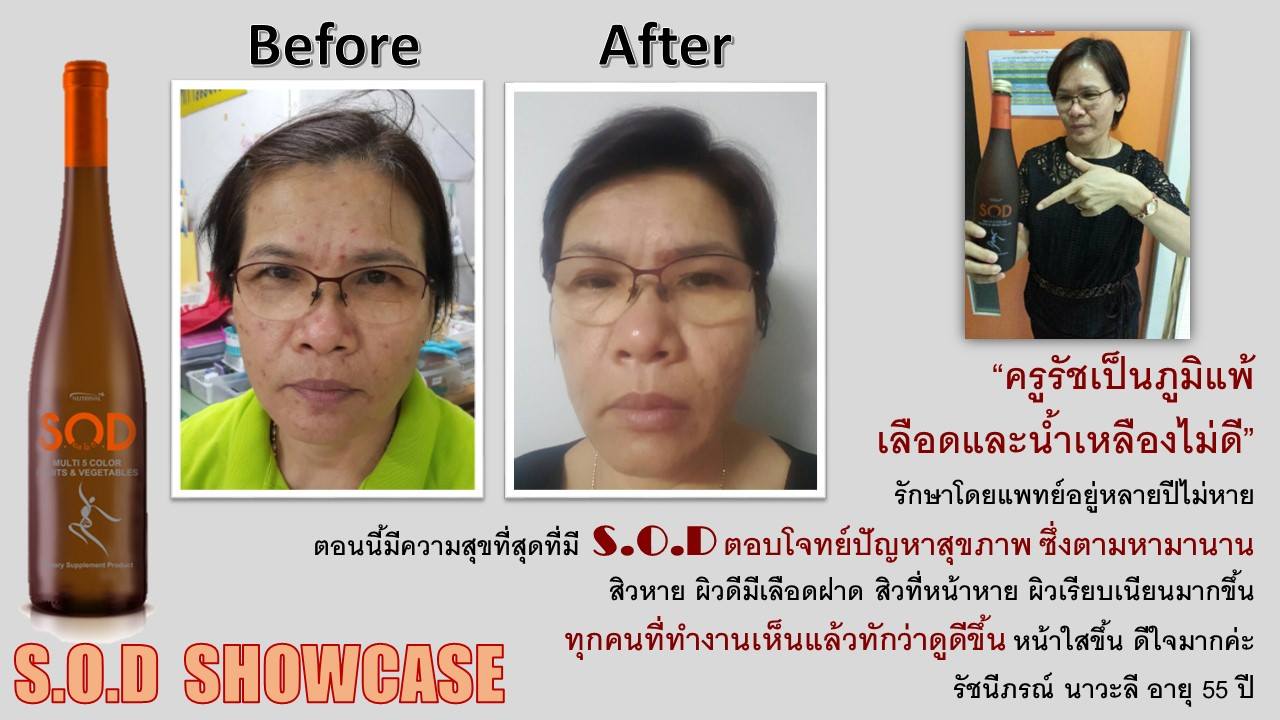 ตัวอย่างผู้ใช้สินค้า SUCCESSMORE S.O.D (10)