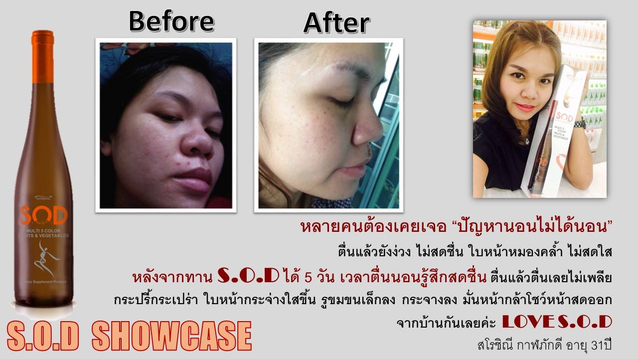 ตัวอย่างผู้ใช้สินค้า SUCCESSMORE S.O.D (11)