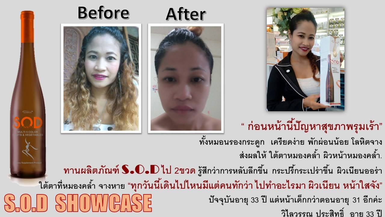 ตัวอย่างผู้ใช้สินค้า SUCCESSMORE S.O.D (12)