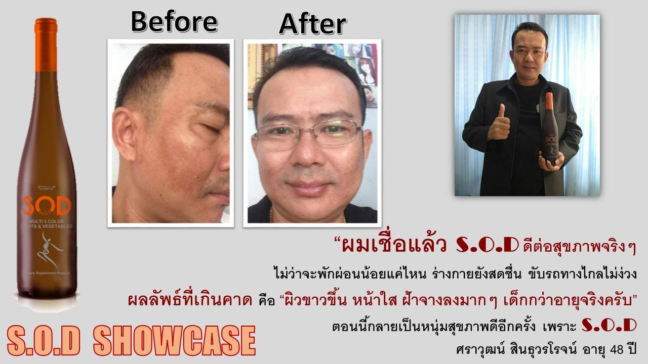ตัวอย่างผู้ใช้สินค้า SUCCESSMORE S.O.D (13)