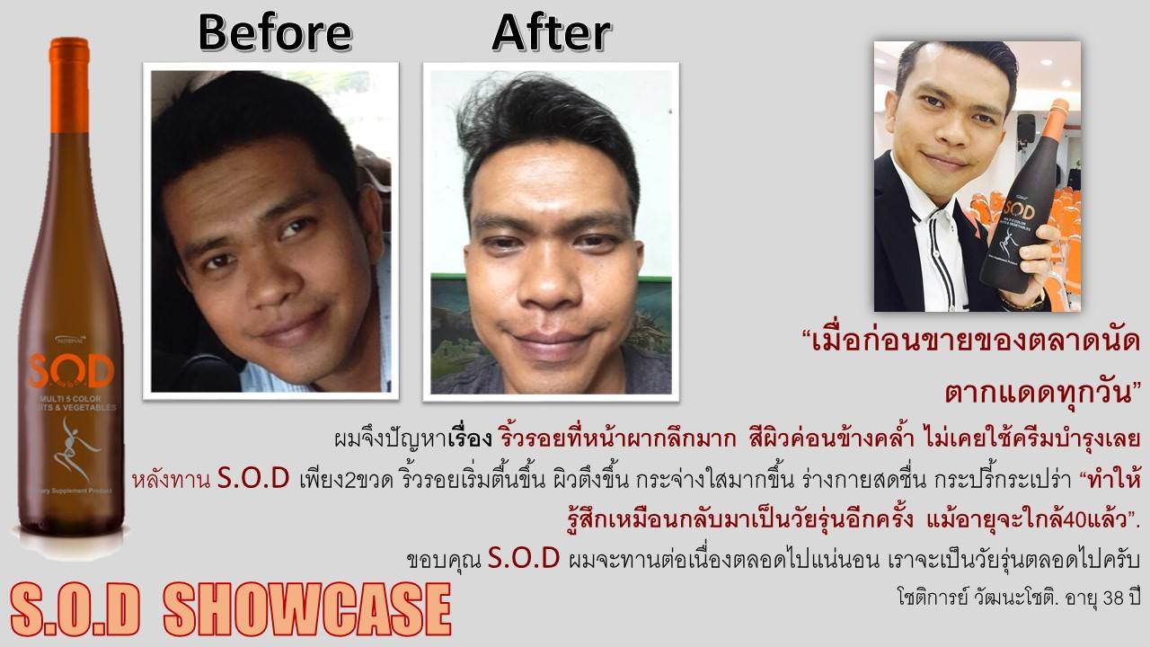 ตัวอย่างผู้ใช้สินค้า SUCCESSMORE S.O.D (15)