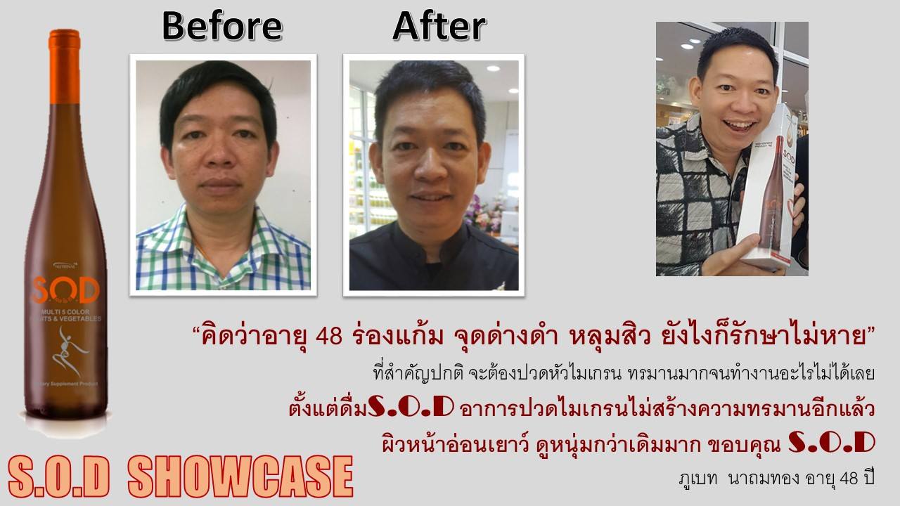 ตัวอย่างผู้ใช้สินค้า SUCCESSMORE S.O.D (16)