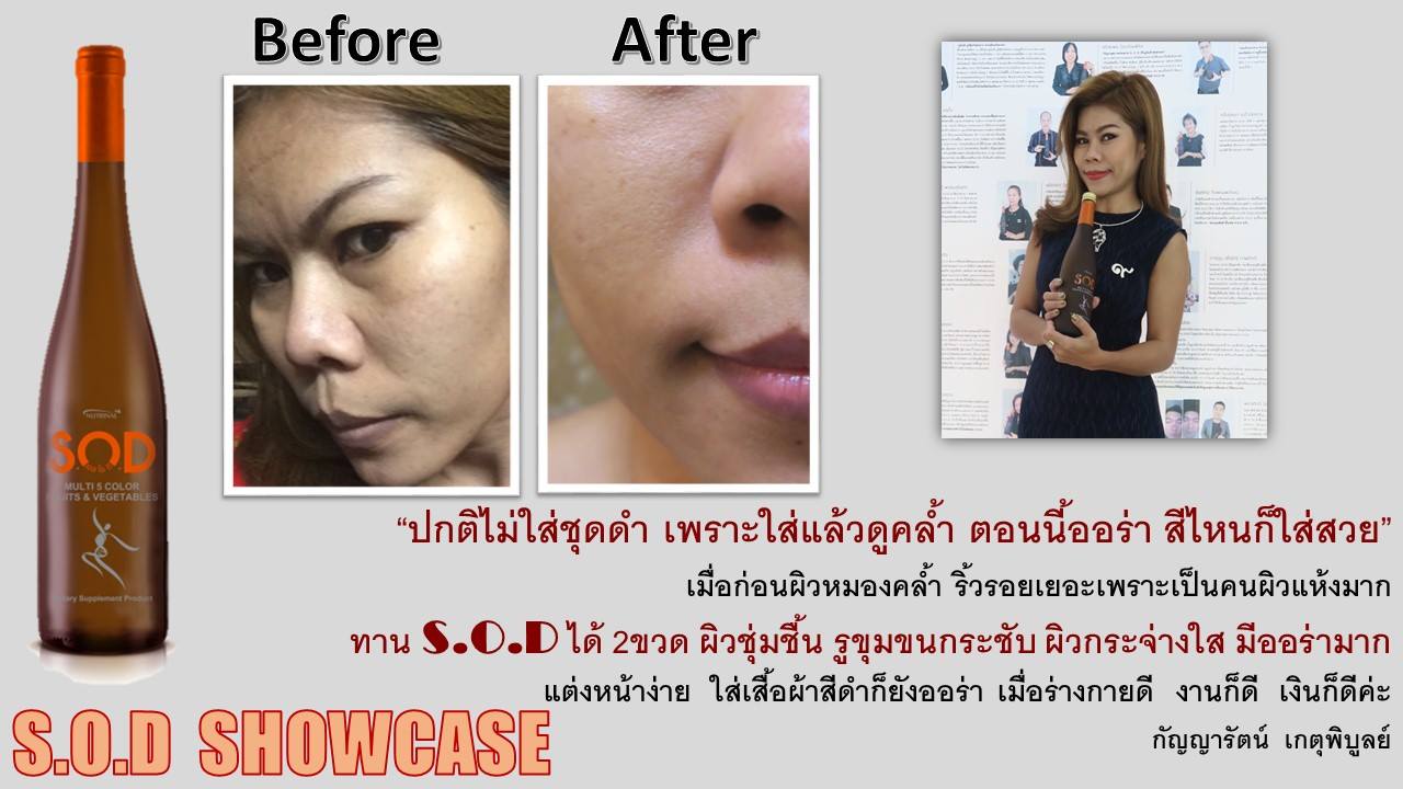 ตัวอย่างผู้ใช้สินค้า SUCCESSMORE S.O.D (17)