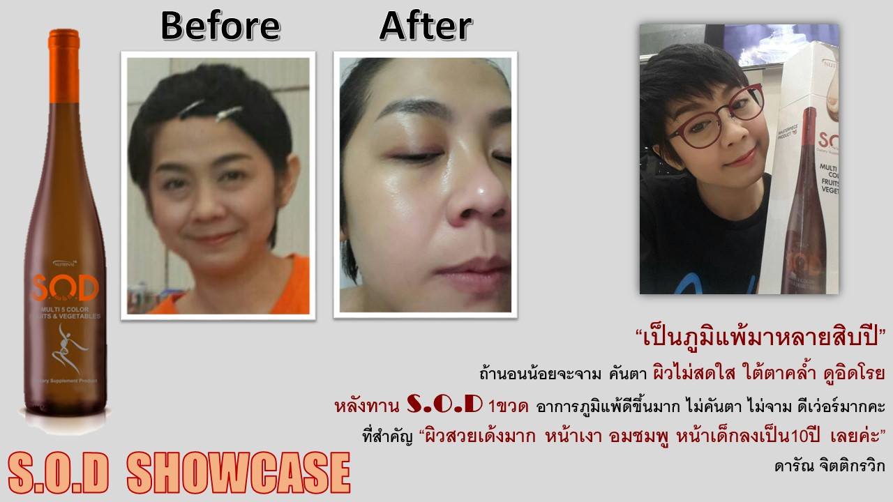 ตัวอย่างผู้ใช้สินค้า SUCCESSMORE S.O.D (18)