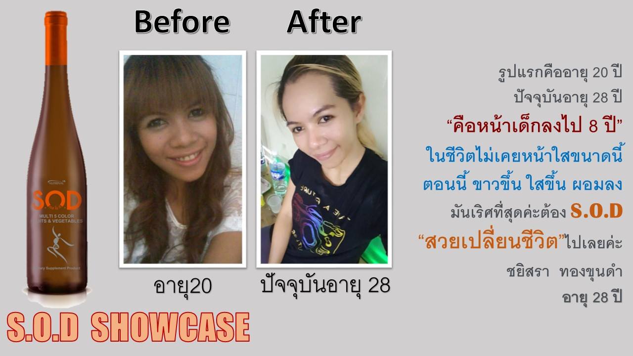 ตัวอย่างผู้ใช้สินค้า SUCCESSMORE S.O.D (2)