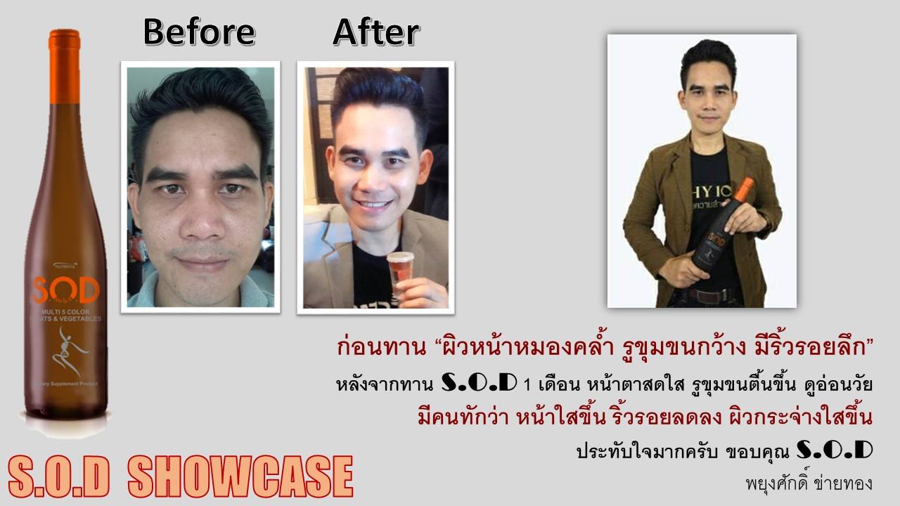 ตัวอย่างผู้ใช้สินค้า SUCCESSMORE S.O.D (22)