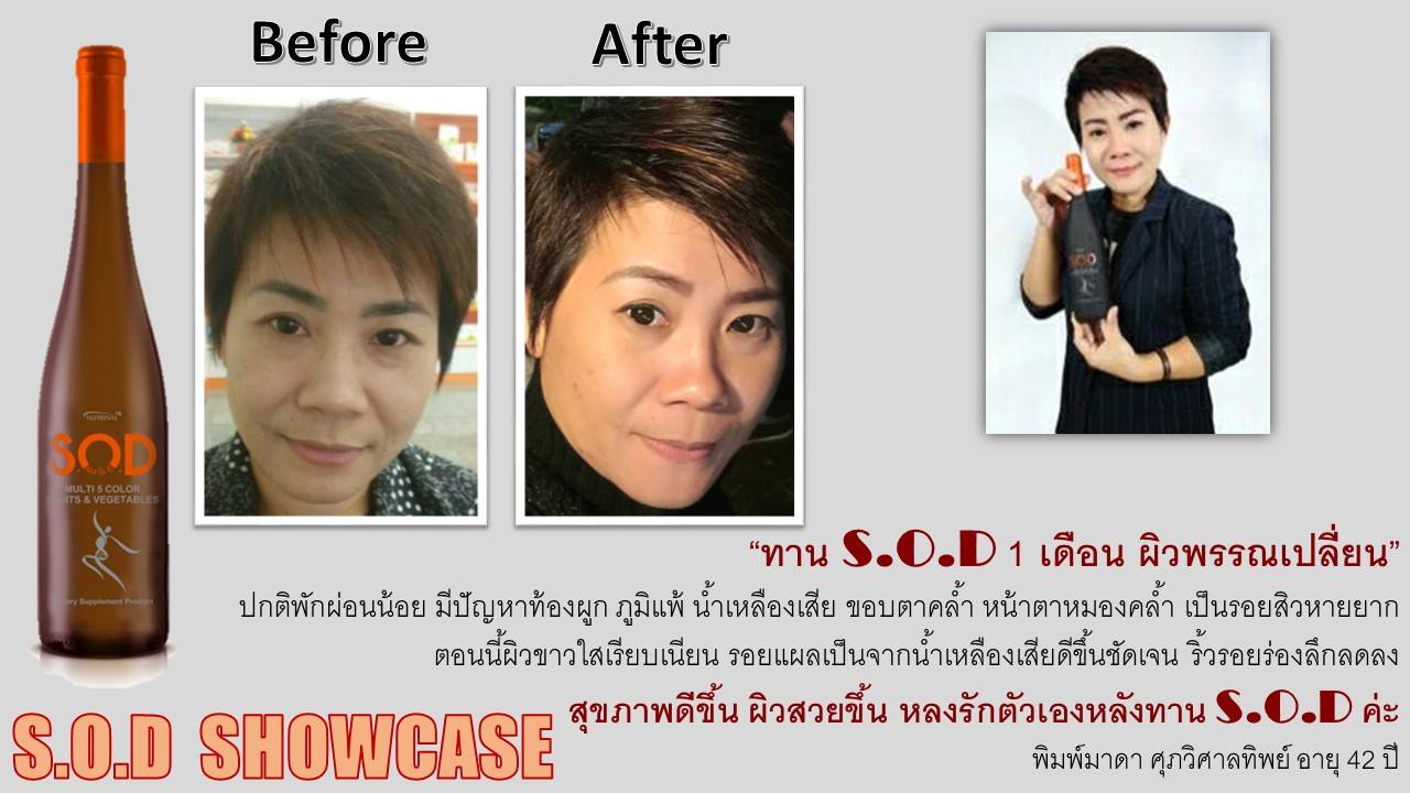 ตัวอย่างผู้ใช้สินค้า SUCCESSMORE S.O.D (23)