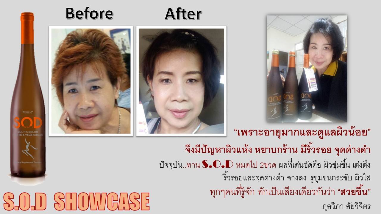 ตัวอย่างผู้ใช้สินค้า SUCCESSMORE S.O.D (24)