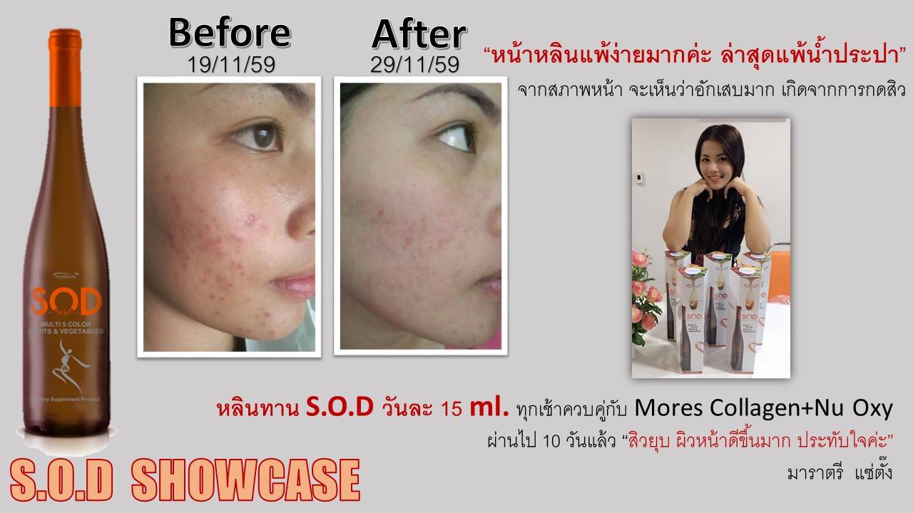 ตัวอย่างผู้ใช้สินค้า SUCCESSMORE S.O.D (6)