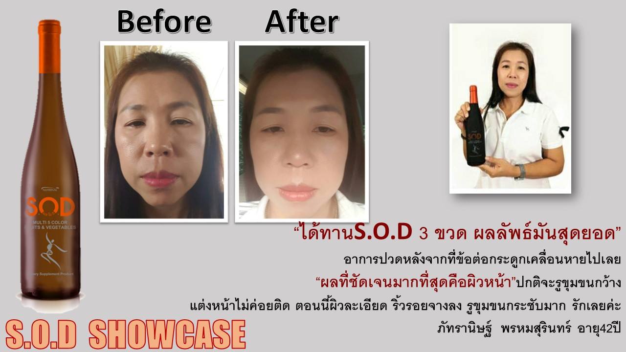 ตัวอย่างผู้ใช้สินค้า SUCCESSMORE S.O.D (8)